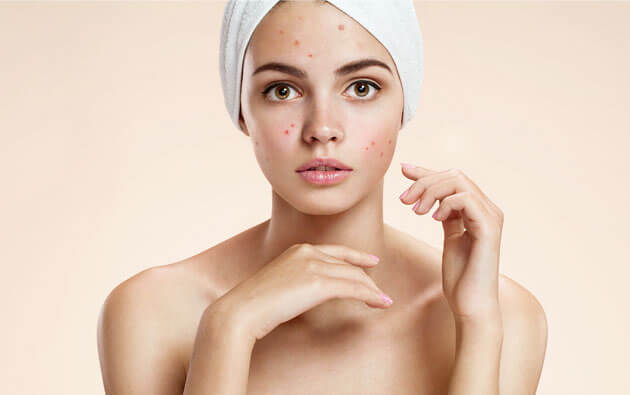Skin pH and Acne