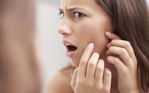 Acne - Do’s and Don’ts