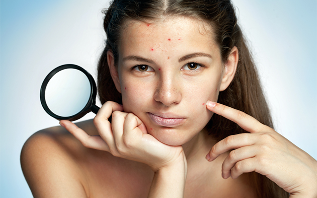 Top secrets to having acne-free and glowing skin