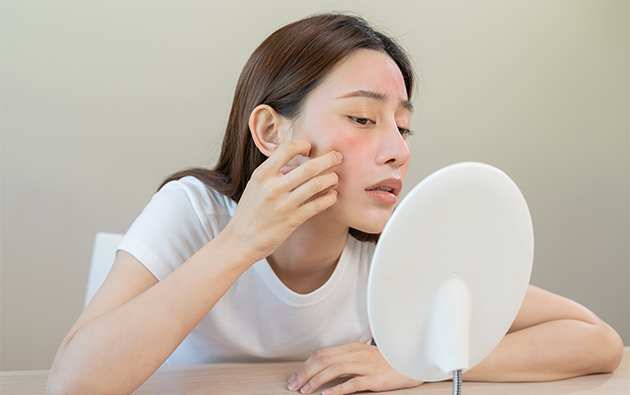 Teen Acne Survival Guide: Things to follow and mistakes to avoid