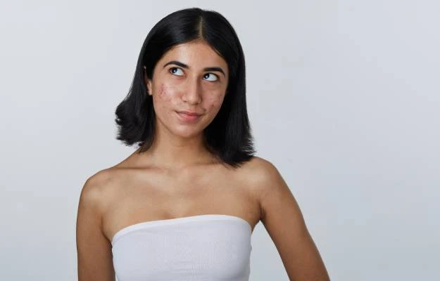 What​‍​‌‍​‍‌​‍​‌‍​‍‌ Your Skin Is Trying to Tell You | Decoded by AI