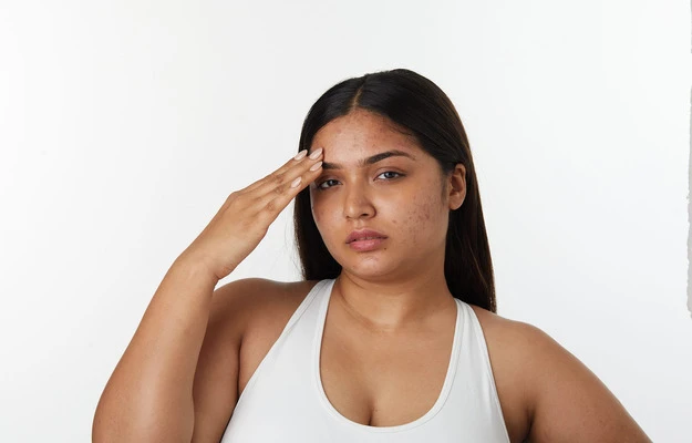 5 Tips for Skin Care During Seasonal Changes
