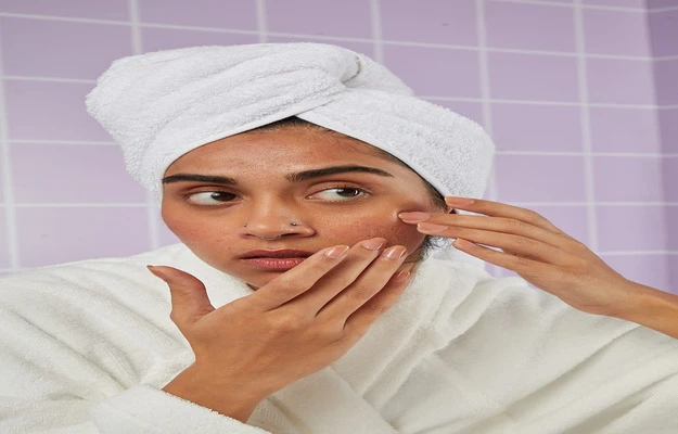 Does Eating Junk Really Cause Pimples? The Truth Finally Answered
