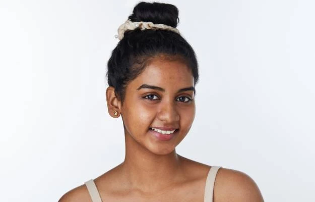 Period Acne: Why It Happens & How to Control It