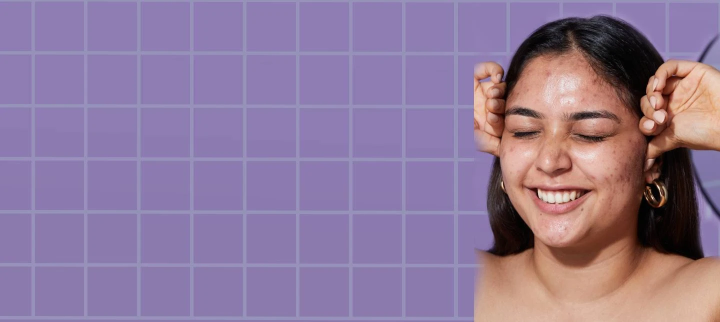 Dry Skin and Acne: Common Causes and Treatments