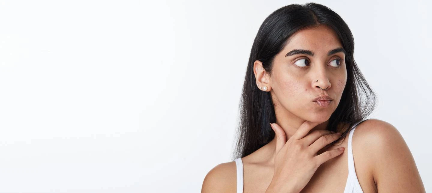 Tips for Preventing Acne Scars in Teenagers