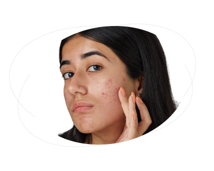 Can Clindamycin + Nicotinamide interact with other medications?