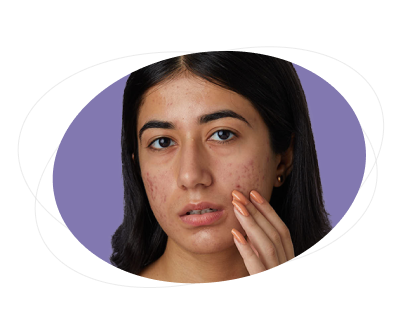 What precautions should I take while using this gel?