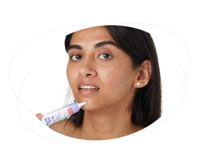 How soon can I expect results from AcneStar products?